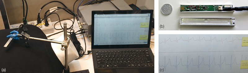 High-sensitivity, high resolution magnetocardiography (MCG) for use at room temperature