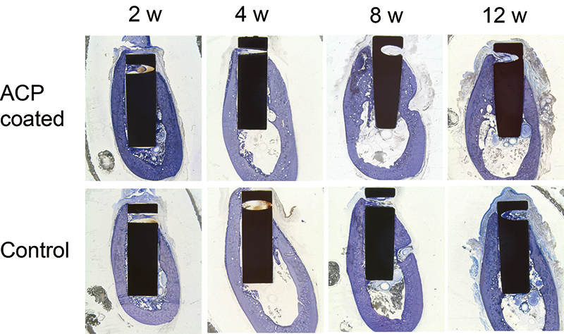 Fig.2 Interface between Ti implant and bone